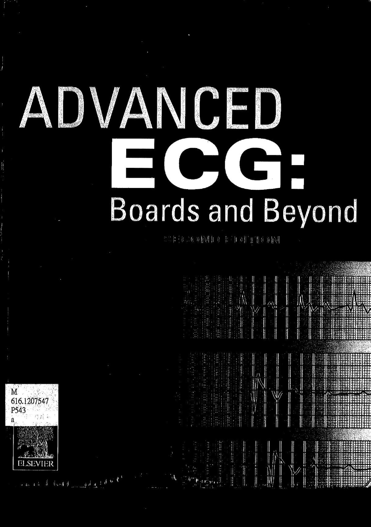Advanced Ecg Boards And Beyond 2nd Edition Brendan Phibbs