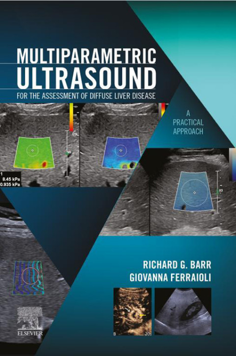 Elastography Of Diffuse Liver Disease Ebook 1st Edition Richard G Barr Giovanna Ferraioli
