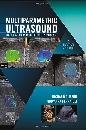 Multiparametric Ultrasound For The Assessment Of Diffuse Liver Disease A Practical Approach 1st Edition Richard G Barr Md Phd Facr Faium Fsru