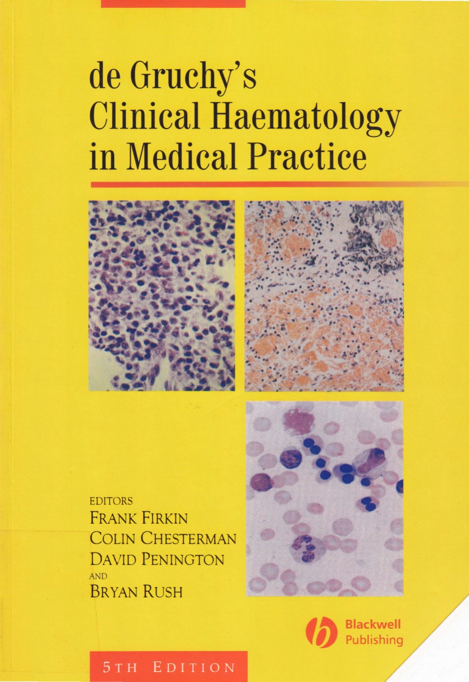 De Gruchys Clinical Haematology In Medical Practice Epz Edition 5th Edition Firkin