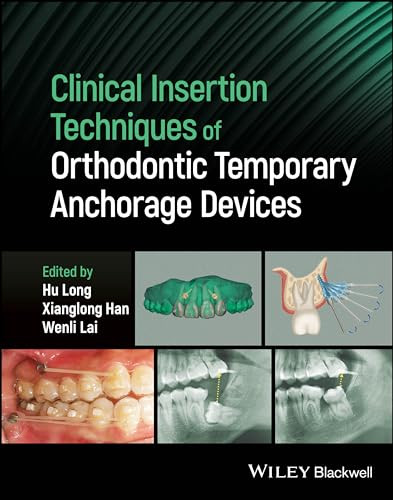 Clinical Insertion Techniques Of Orthodontic Temporary Anchorage Devices 1st Edition H Long
