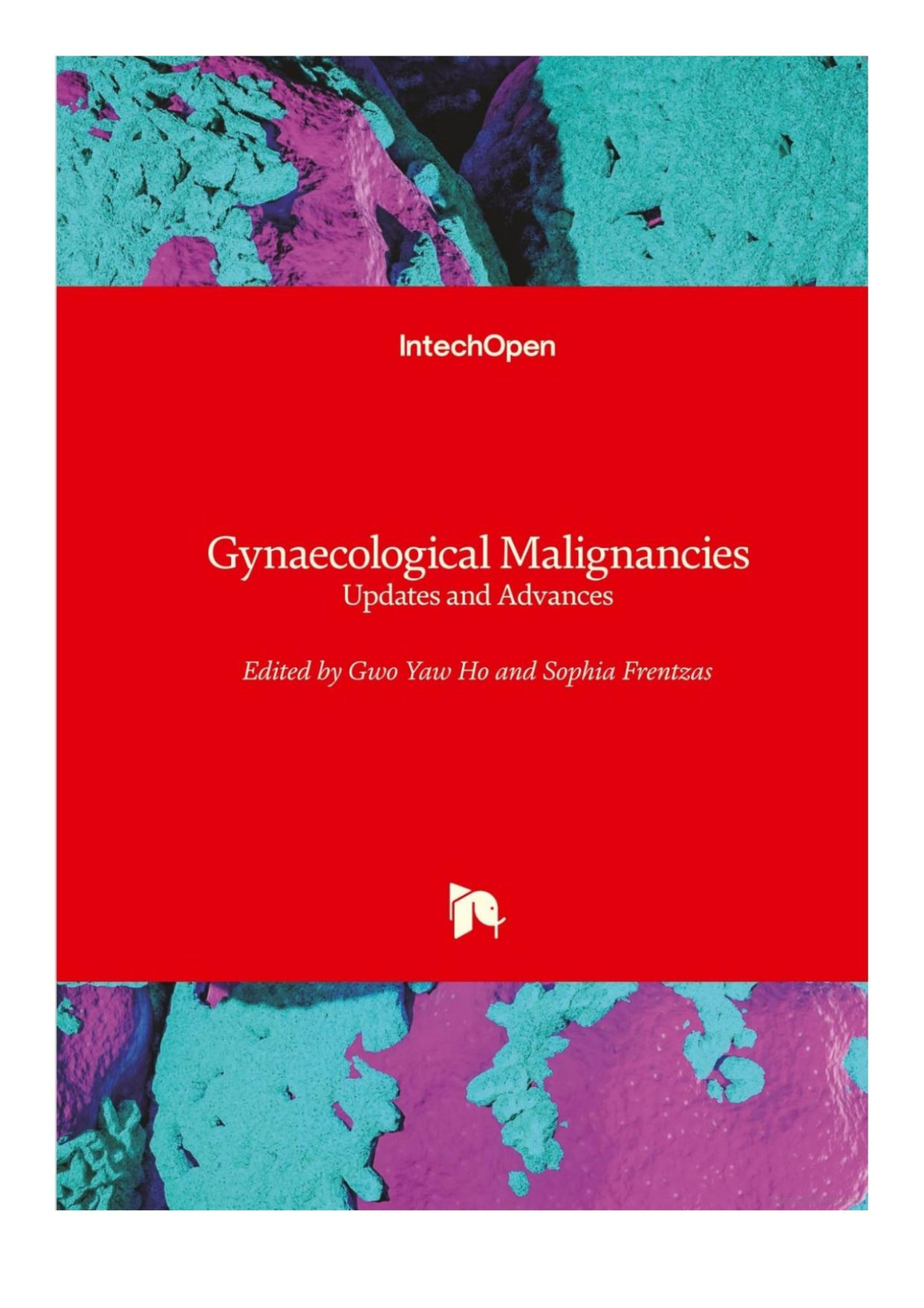 Gynaecological Malignancies Updates And Advances Gwo Yaw Ho