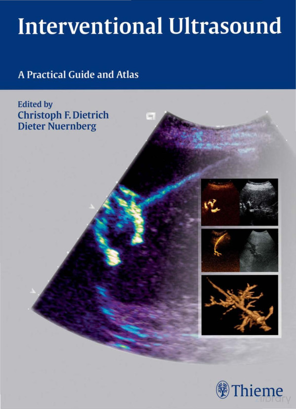 Interventional Ultrasound A Practical Guide And Atlas October 22 20143131708212thieme Illustrated Nrnberg