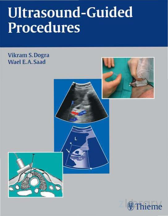 Ultrasound Guided Procedures 1st Edition Dogra Vikram S Saad