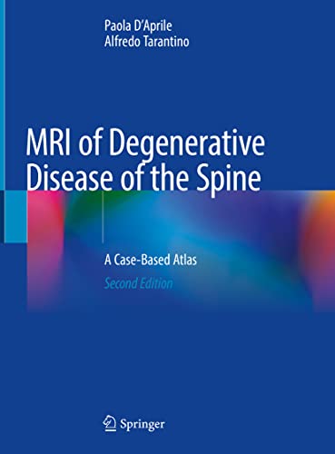Mri Of Degenerative Disease Of The Spine A Casebased Atlas 2nd Ed 2021 Paola Daprile