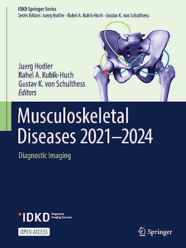 Musculoskeletal Diseases 20212024 Diagnostic Imaging 1st Ed 2021 Juerg Hodler