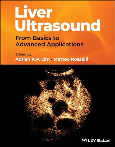 Liver Ultrasound From Basics To Advanced Applications June 4 20241119612594wileyblackwell 1st Edition A Lim