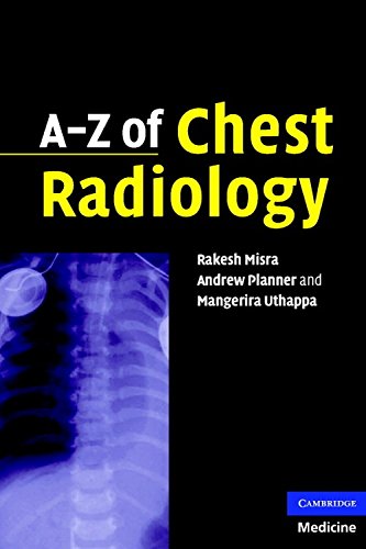 Az Of Chest Radiology 1st Edition Planner Andrew Uthappa Mangerira