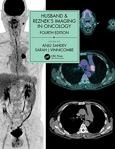 Husband Rezneks Imaging In Oncology 4th Edition Anju Sahdev