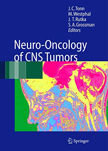 Neurooncology Of Cns Tumors 1st Edition Jc Tonn Stuart A Grossman