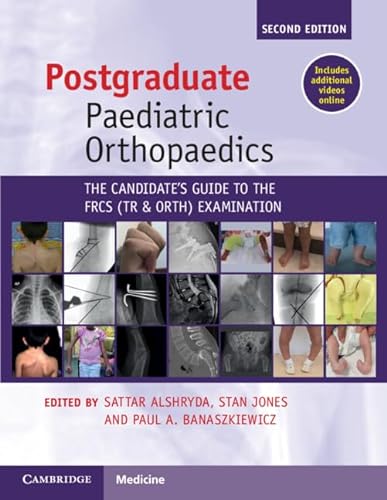 Postgraduate Paediatric Orthopaedics The Candidates Guide To The Frcstrorth Examination 2nd Edition Sattar Alshryda