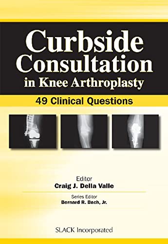 Curbside Consultation In Knee Arthroplasty 49 Clinical Questions First Edition Editorcraig J Della Valle Md