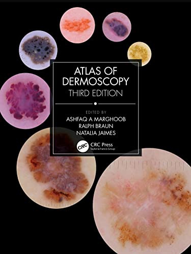 Atlas Of Dermoscopy 3rd Edition 3rd Ashfaq A Marghoob Natalia Jaimes