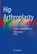 Hip Arthroplasty Current And Future Directions 1st Edition Mrinal Sharma