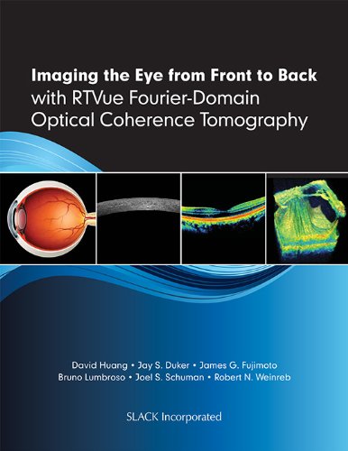 Imaging The Eye From Front To Back With Rtvue Fourierdomain Optical Coherence Tomogaphy 1st Edition Huang Md Phd