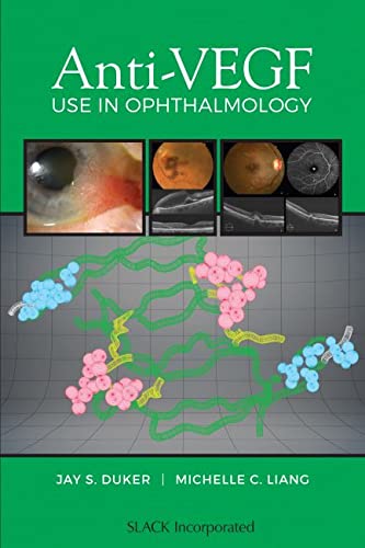 Antivegf Use In Ophthalmology 1st Edition Duker Md Jay S Liang Md