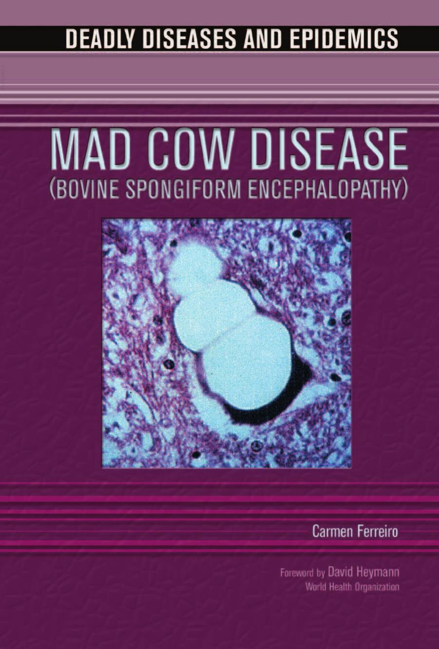 Mad Cow Disease Bovine Spongiform Encephalopathy Carmen Ferreiro