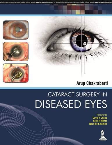 Cataract Surgery In Diseased Eyes 1e Arup Chakrabarti