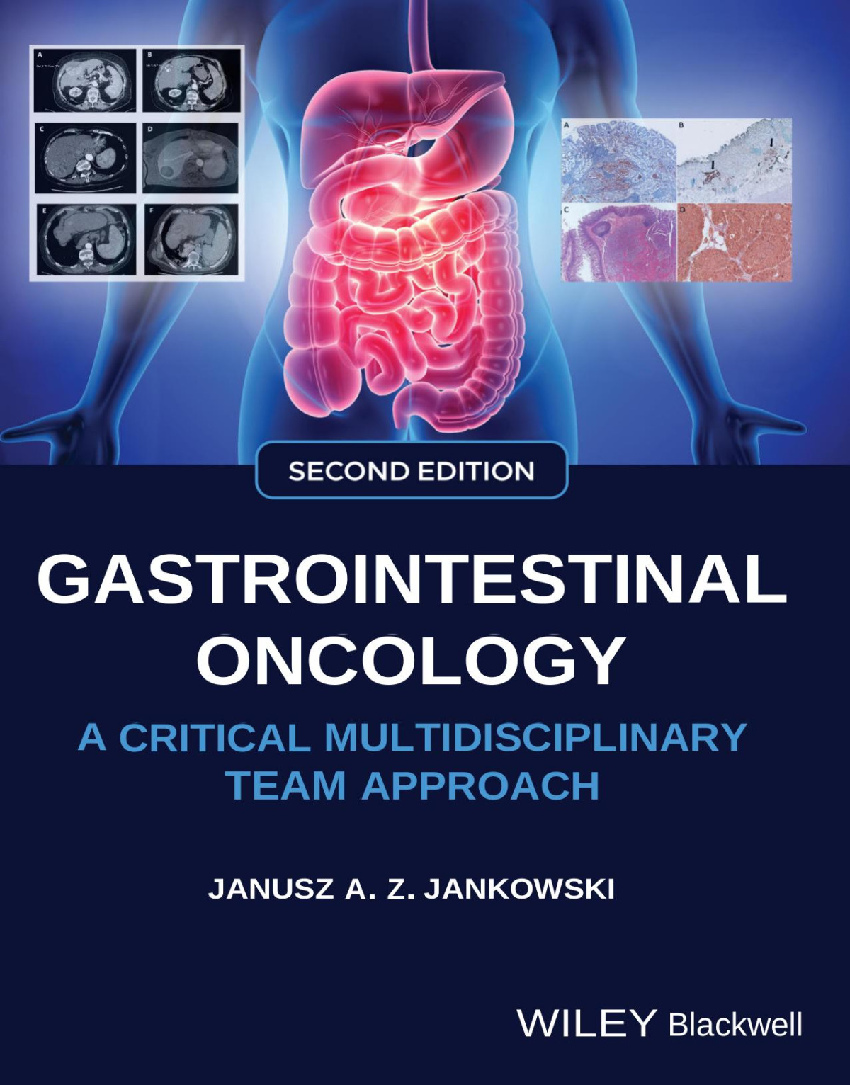 Gastrointestinal Oncology A Critical Multidisciplinary Team Approach Wileyblackwell