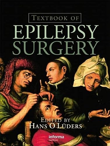 Textbook Of Epilepsy Surgery 1st Edition Hans O Luders