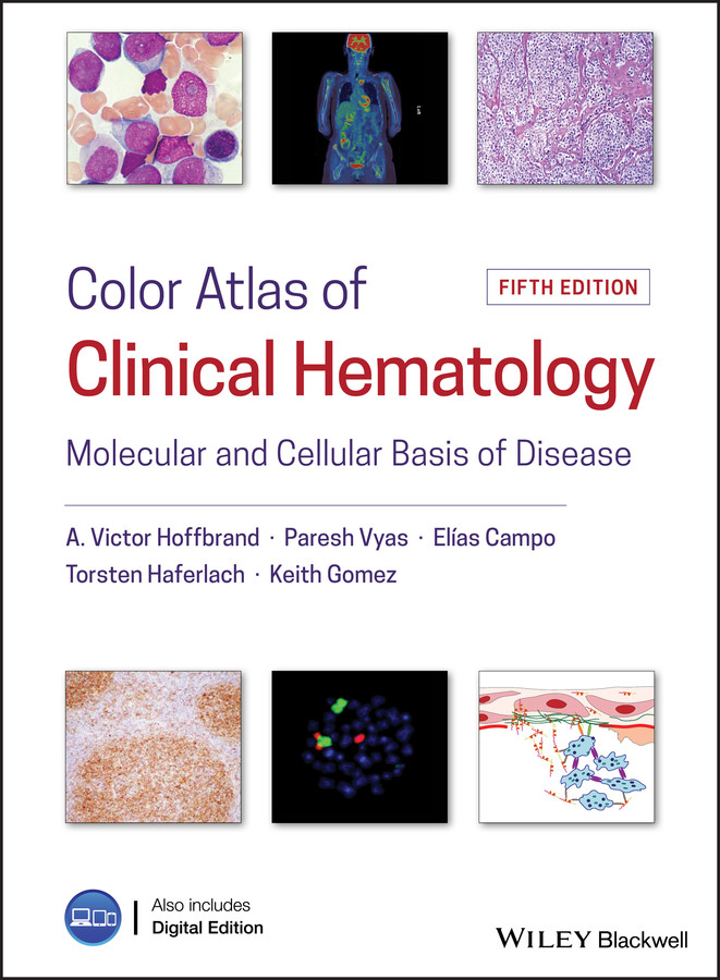 Color Atlas Of Clinical Hematology Molecular And Cellular Basis Of Disease Hoffbrand