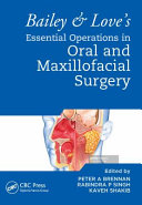 Bailey Loves Essential Operations In Oral Maxillofacial Surgery Peter A Brennan