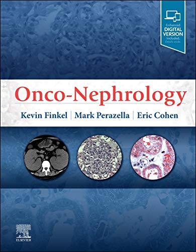 Onconephrology 1st Edition Finkel Kevin W Perazella Mark A Cohen