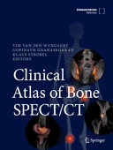 Clinical Atlas Of Bone Spectct Tim Van Den Wyngaert Gopinath Gnanasegaran