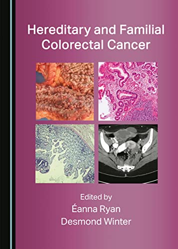Hereditary And Familial Colorectal Cancer 1st Edition Anna Ryan