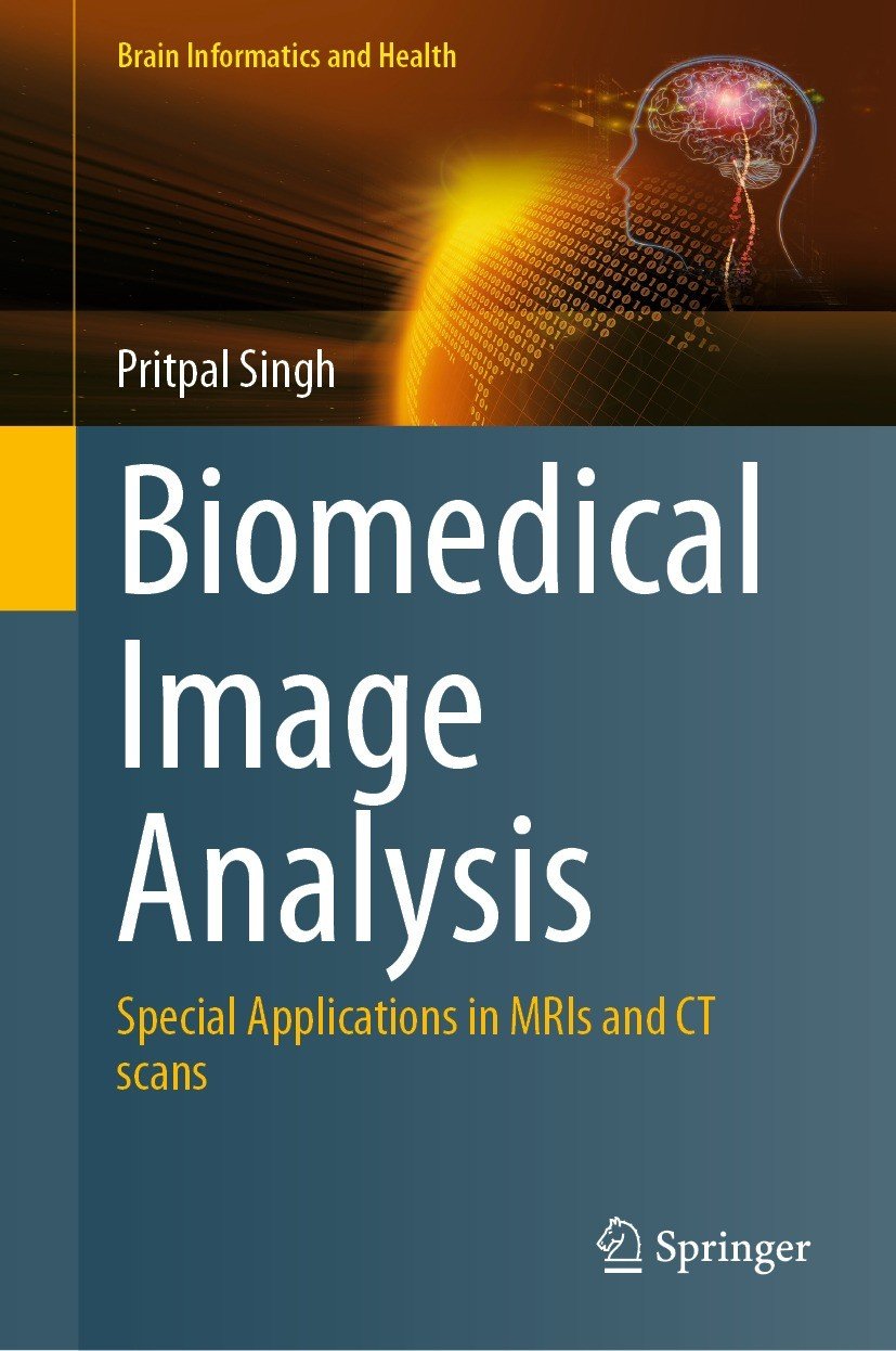 Biomedical Image Analysis Special Applications In Mris And Ct Scans Pritpal Singh