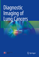 Diagnostic Imaging Of Lung Cancers Song Zhang