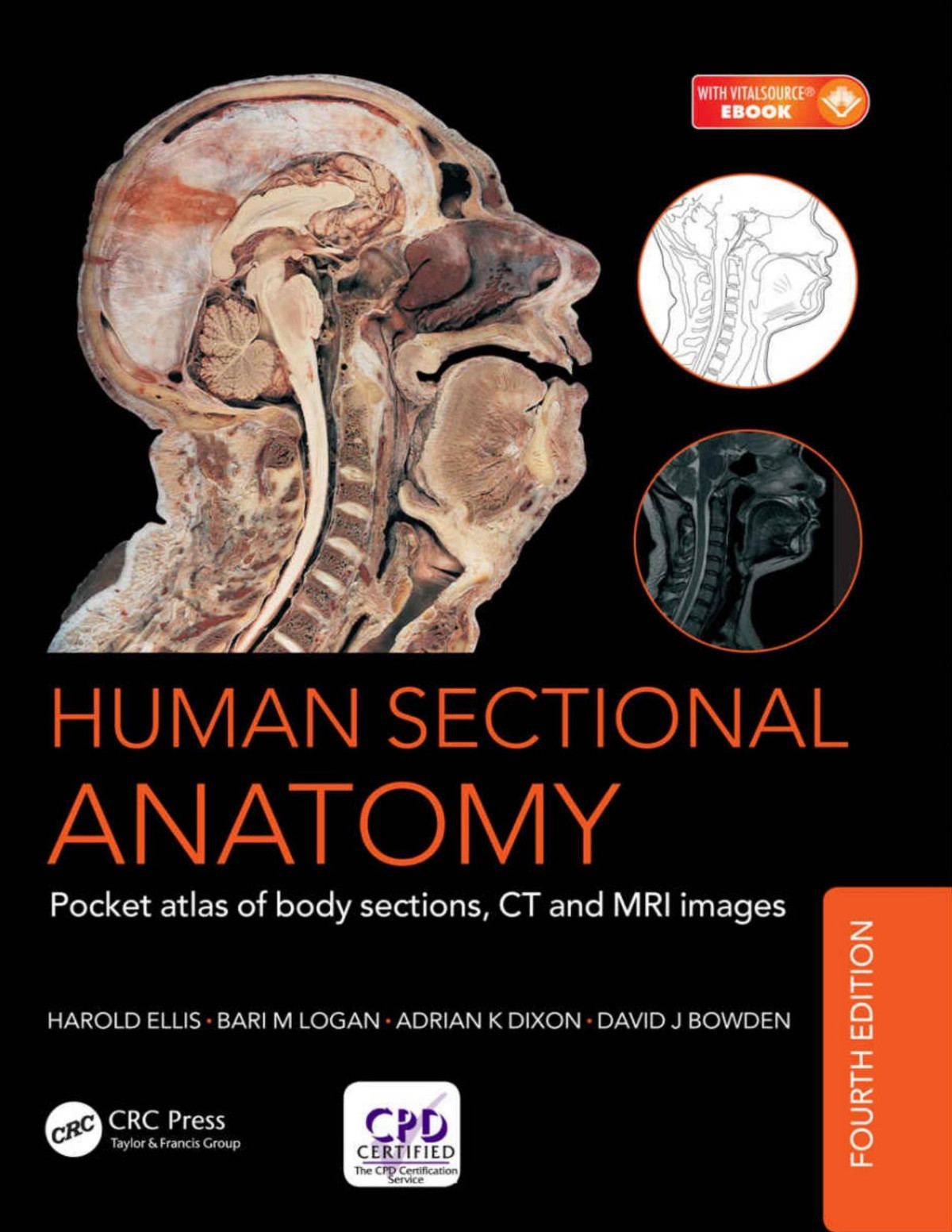 Human Sectional Anatomy Adrian Kendal Dixon David J Bowden Bari M Logan Harold Ellis
