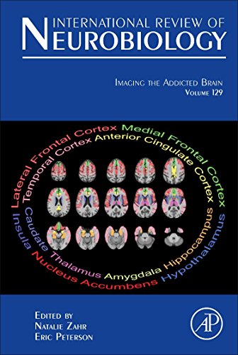 Imaging The Addicted Brain 1st Edition Natalie M Zahr And Eric T Peterson Eds