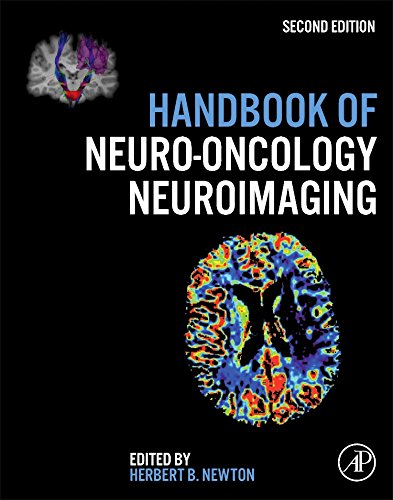 Handbook Of Neurooncology Neuroimaging 2nd Edition Herbert B Newton