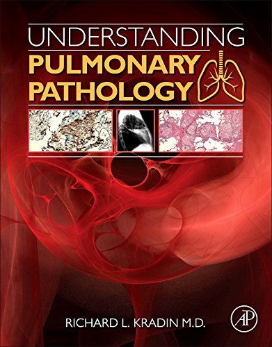 Understanding Pulmonary Pathology Applying Pathological Findings In Therapeutic Decision Making 1st Edition Richard L Kradin