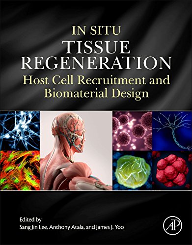 In Situ Tissue Regeneration Host Cell Recruitment And Biomaterial Design 1st Edition Sang Jin Lee