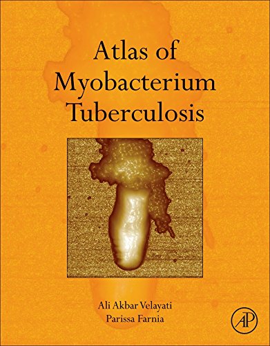 Atlas Of Myobacterium Tuberculosis 1st Edition Ali Akbar Velayati