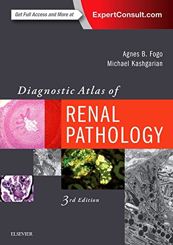 Diagnostic Atlas Of Renal Pathology 3rd Edition Agnes B Fogo