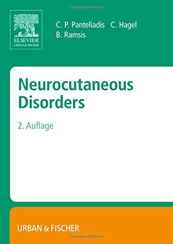 Neurocutaneous Disorders 2nd Edition Benjamin Ramsis Hagel Christian Panteliadis