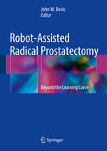 Robotassisted Radical Prostatectomy Beyond The Learning Curve 1st Edition John W Davis Eds