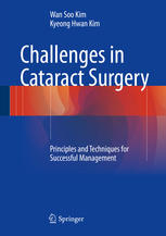 Challenges In Cataract Surgery Principles And Techniques For Successful Management 1st Edition Wan Soo Kim