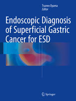 Endoscopic Diagnosis Of Superficial Gastric Cancer For Esd 1st Edition Tsuneo Oyama