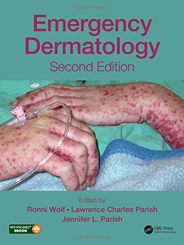 Emergency Dermatology Second Edition Ronni Wolf Md