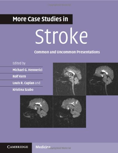 More Case Studies In Stroke Common And Uncommon Presentations 1st Edition Michael G Hennerici