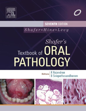Shafers Textbook Of Oral Pathology 7th Edition Arya Rajendran