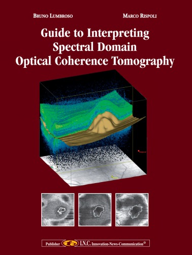 Guide To Interpreting Spectral Domain Opitcal Coherence Tomography Bruno Lumbroso