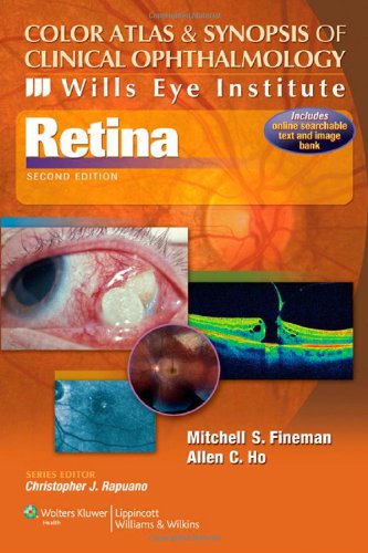 Color Atlas And Synopsis Of Clinical Ophthalmology Retina 2nd Edition Mitchell S Finema