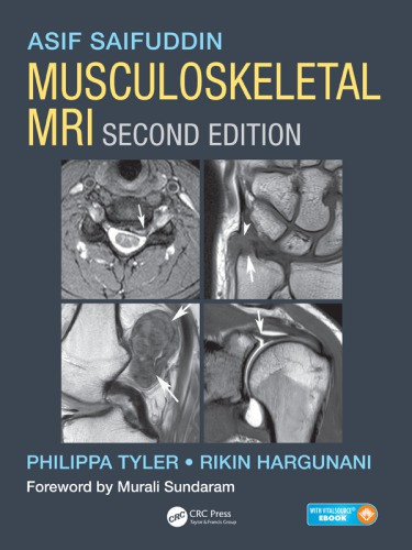 Musculoskeletal Mri 2nd Edition Hargunani Rikin Saifuddin Asif Tyler