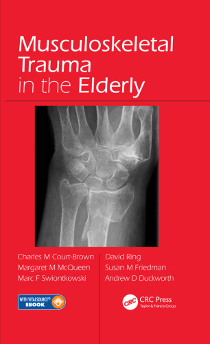 Musculoskeletal Trauma In The Elderly Courtbrown Charles Duckworth