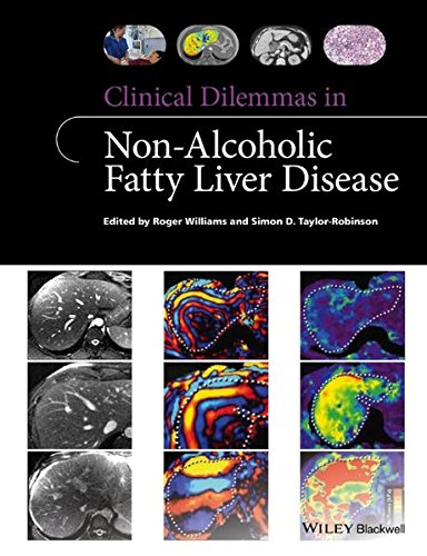 Clinical Dilemmas In Nonalcoholic Fatty Liver Disease Clinical Dilemmas 1st Edition Roger Williams
